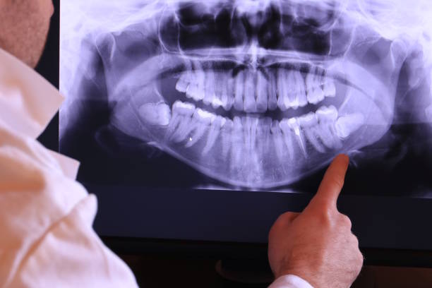 Best Broken or Cracked Tooth Emergency Dentist in Manchester, VA