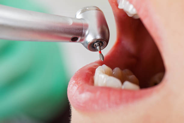 Best Mobile Emergency Dentist in Manchester, VA